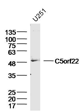 Fig1: Sample:U251(human) Cell Lysate at 40 ug; Primary: Anti-C5orf22 at 1/300 dilution; Secondary: IRDye800CW Goat Anti-Rabbit IgG at 1/20000 dilution; Predicted band size: 50kD; Observed band size: 50kD