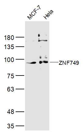 Fig1: Sample:; MCF-7(Human) Cell Lysate at 40 ug; Hela(Human) Cell Lysate at 40 ug; Primary: Anti-ZNF749 at 1/300 dilution; Secondary: IRDye800CW Goat Anti-Rabbit IgG at 1/20000 dilution; Predicted band size: 90 kD; Observed band size: 90 kD