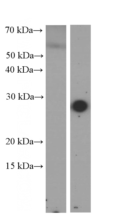 Serum from normal mouse (left) and mouse injected with bacteria (right) were subjected to SDS PAGE followed by western blot with Catalog No:107177 (CRP Antibody) at dilution of 1:500. Horseradish peroxidase conjugated protein A was used for signal developing instead of secondary antibody.