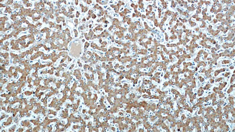Immunohistochemical of paraffin-embedded human liver using Catalog No:114942(RWDD3 antibody) at dilution of 1:50 (under 10x lens)
