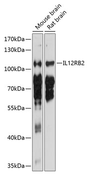 Western blot - IL12RB2 Polyclonal Antibody 