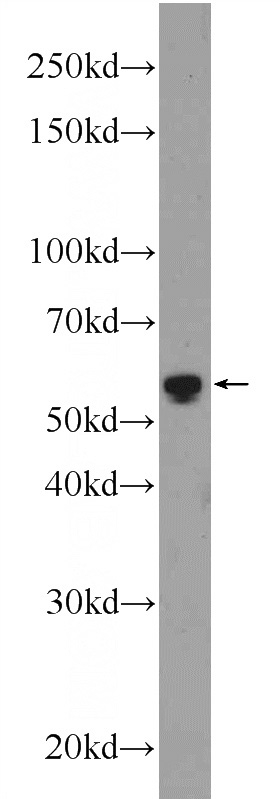 mouse kidney tissue were subjected to SDS PAGE followed by western blot with Catalog No:111147(GPT2 Antibody) at dilution of 1:600