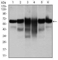 Western blot analysis using CK5 mouse mAb against A431 (1), MCF-7 (2), HeLa (3), HepG2 (4), 3T3-L1 (5), and COS-7 (6) cell lysate.