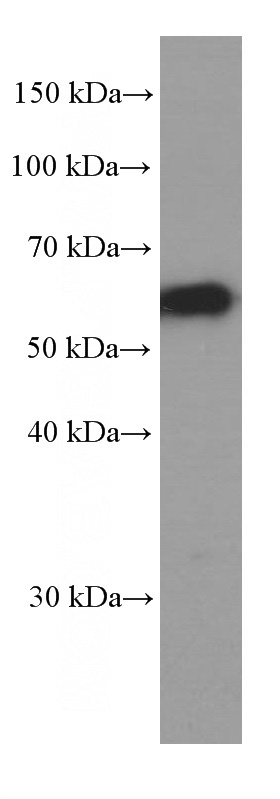 L02 cells were subjected to SDS PAGE followed by western blot with Catalog No:107447(P62;SQSTM1 Antibody) at dilution of 1:2000