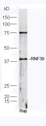 Fig1: Protein: Raji lysate at 40ug;; Primary: rabbit Anti-RNF39 at 1:300;; Secondary: HRP conjugated Goat-Anti-rabbit IgG(bs-0295G-HRP) at 1: 5000;; Predicted band size: 38/45 kD; Observed band size: 38 kD