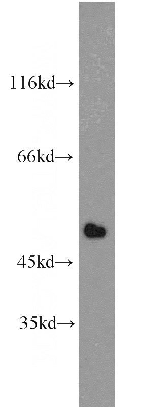 mouse heart tissue were subjected to SDS PAGE followed by western blot with Catalog No:111842(IRF9 antibody) at dilution of 1:500