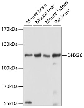 Western blot - DHX36 Polyclonal Antibody 
