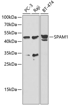 Western blot - SPAM1 Polyclonal Antibody 
