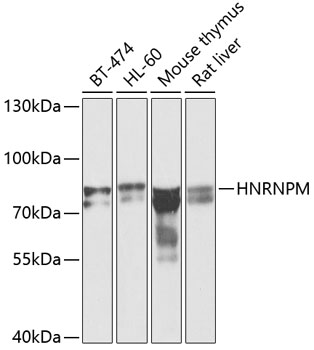 Western blot - HNRNPM Polyclonal Antibody 