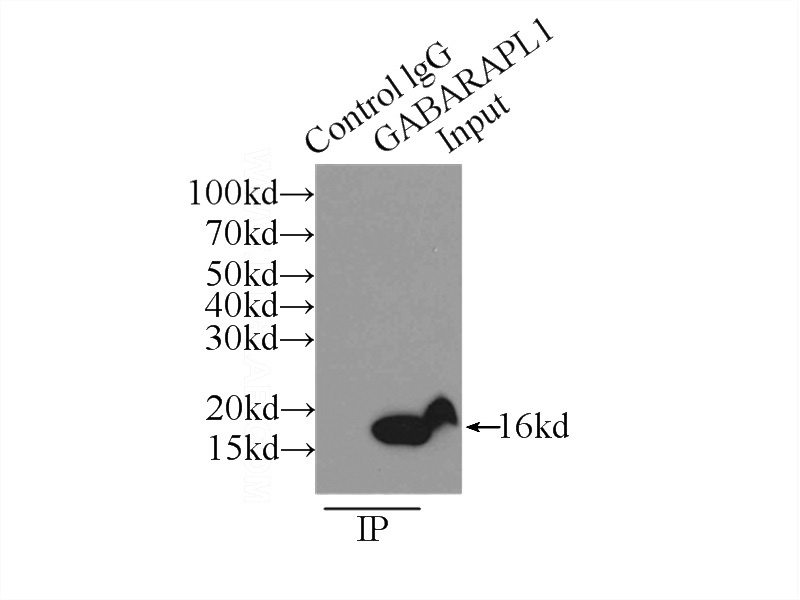 IP Result of anti-ATG8L (IP:Catalog No:110800, 3ug; Detection:Catalog No:110800 1:500) with mouse liver tissue lysate 5000ug.