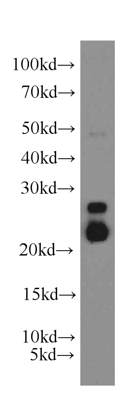mouse liver tissue were subjected to SDS PAGE followed by western blot with Catalog No:108198(ARL2 antibody) at dilution of 1:500