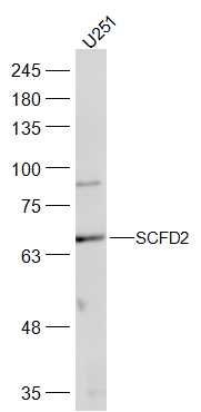 Fig2: Sample:; U251(Human) Cell Lysate at 30 ug; Primary: Anti-SCFD2 at 1/300 dilution; Secondary: IRDye800CW Goat Anti-Rabbit IgG at 1/20000 dilution; Predicted band size: 75 kD; Observed band size: 69 kD