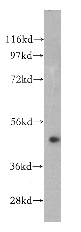 Jurkat cells were subjected to SDS PAGE followed by western blot with Catalog No:113263(NOB1 antibody) at dilution of 1:500
