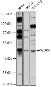 Western blot - WDR4 Polyclonal Antibody 