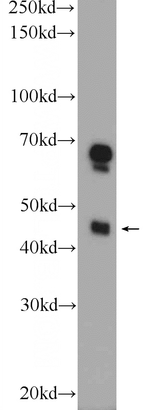 HeLa cells were subjected to SDS PAGE followed by western blot with Catalog No:116094(TMEM120A Antibody) at dilution of 1:300