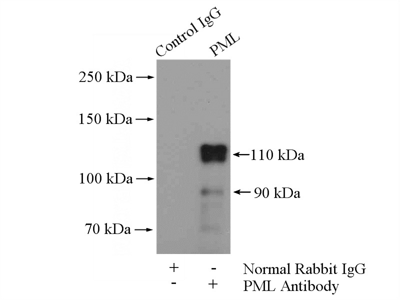 IP Result of anti-PML (IP:Catalog No:114024, 4ug; Detection:Catalog No:114024 1:500) with HEK-293 cells lysate 3200ug.