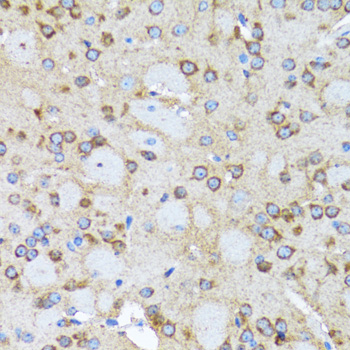 Western blot - ACTR2 Polyclonal Antibody 