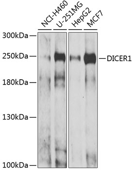 Western blot - DICER1 Polyclonal Antibody 