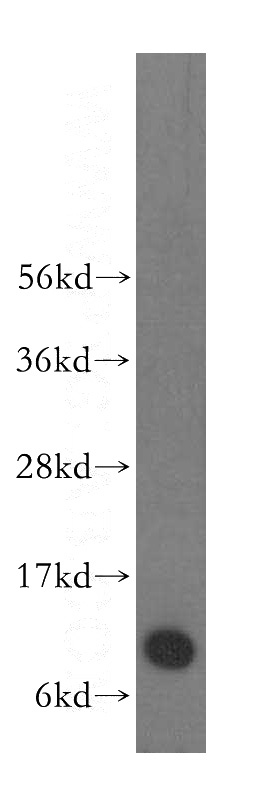 HeLa cells were subjected to SDS PAGE followed by western blot with Catalog No:114963(S100A6 antibody) at dilution of 1:800
