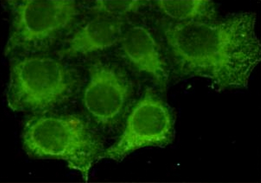 Immunocytochemistry staining of HeLa cells fixed by anhydrous methanol for 2 h at -20u2103 and using anti-Keratin 18 mouse mAb (dilution 1:800).