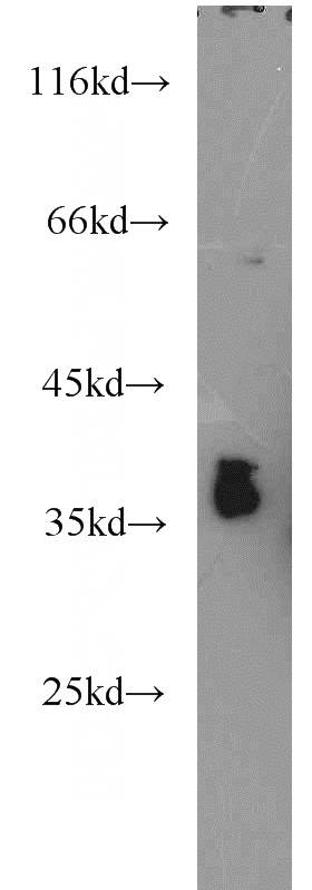Y79 cells were subjected to SDS PAGE followed by western blot with Catalog No:109582(CRX antibody) at dilution of 1:500