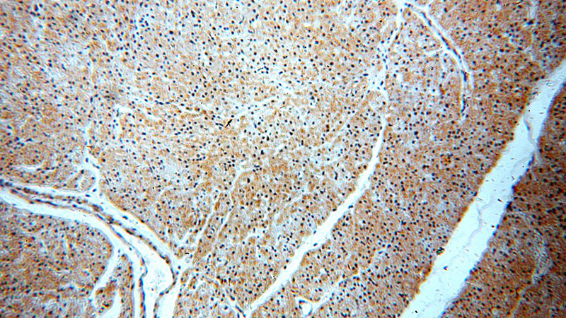 Immunohistochemical of paraffin-embedded human heart using Catalog No:115180(SH2D2A antibody) at dilution of 1:50 (under 10x lens)