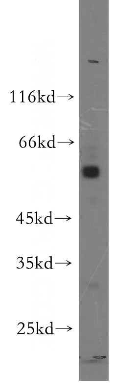 A549 cells were subjected to SDS PAGE followed by western blot with Catalog No:114332(PTRF antibody) at dilution of 1:1000