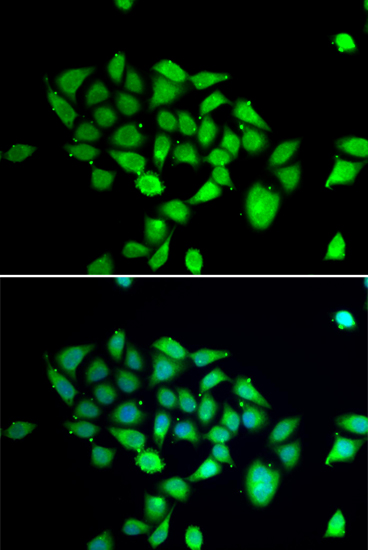 Immunofluorescence - DPP8 Polyclonal Antibody 