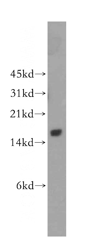 Jurkat cells were subjected to SDS PAGE followed by western blot with Catalog No:110824(GAGE1 antibody) at dilution of 1:500