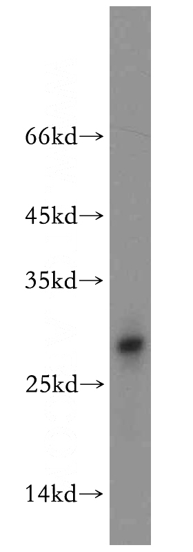 mouse brain tissue were subjected to SDS PAGE followed by western blot with Catalog No:116457(TXNL6 antibody) at dilution of 1:800