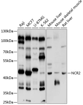 Western blot - NCR2 Polyclonal Antibody 
