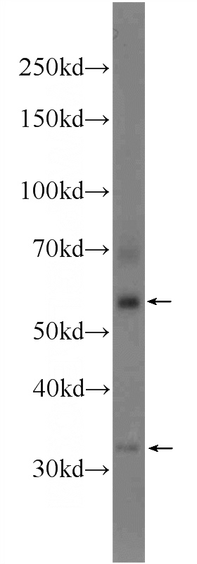 mouse testis tissue were subjected to SDS PAGE followed by western blot with Catalog No:117117(BEND4 Antibody) at dilution of 1:1000