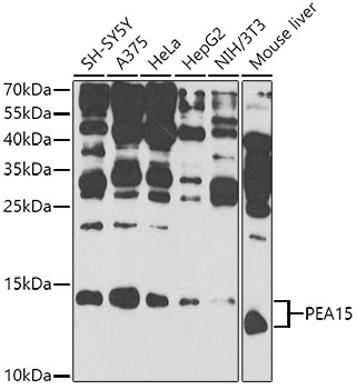 Western blot - PEA15 Polyclonal Antibody 