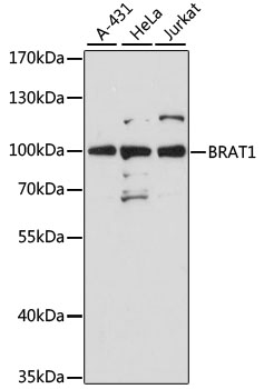 Western blot - BRAT1 Polyclonal Antibody 