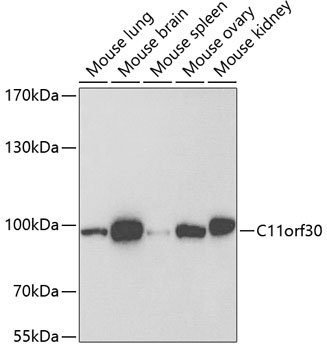 Western blot - C11orf30 Polyclonal Antibody 