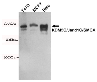 Western blot detection of KDM5C / Jarid1C / SMCX in T47D,MCF7 and Hela cell lysates using KDM5C / Jarid1C / SMCX mouse mAb (1:500 diluted).Predicted band size: 176KDa.Observed band size: 220KDa.