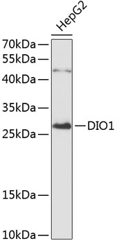 Western blot - DIO1 Polyclonal Antibody 
