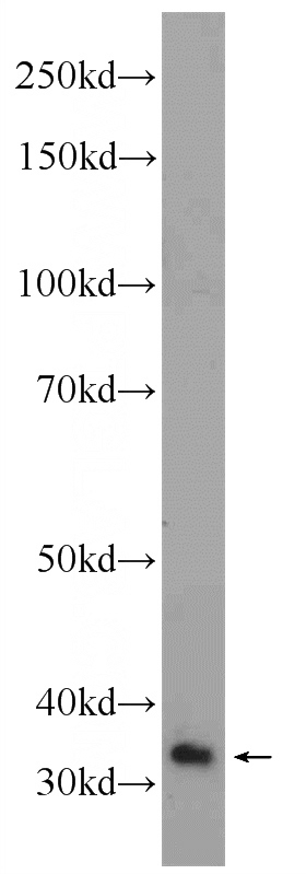 HeLa cells were subjected to SDS PAGE followed by western blot with Catalog No:110497(EXD1 Antibody) at dilution of 1:300