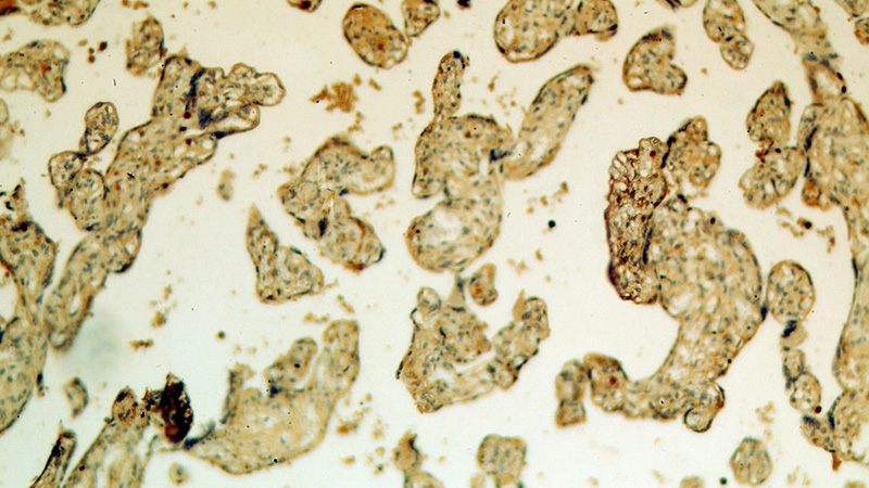 Immunohistochemical of paraffin-embedded human placenta using Catalog No:109594(CSF2RA antibody) at dilution of 1:50 (under 10x lens)