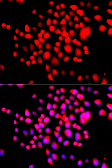 Immunofluorescence - STK19 Polyclonal Antibody 