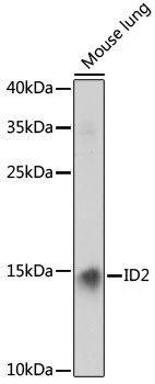 Western blot - ID2 Polyclonal Antibody 