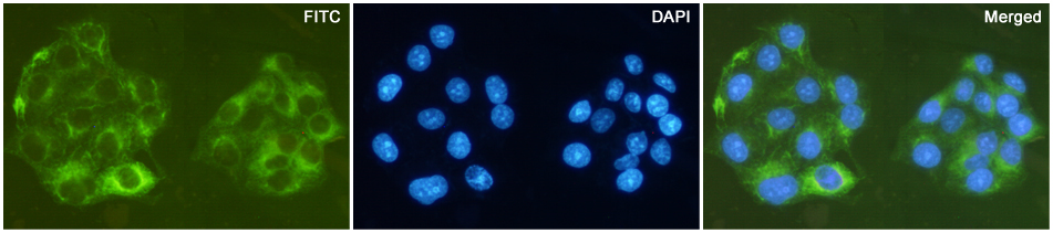Immunofluorescent analysis of HeLa cells fixed with -20℃ Methanol and using Cytokeratin (Pan) Mouse mAb (168509,dilution 1:500,green). DAPI was used to stain nucleus(blue).