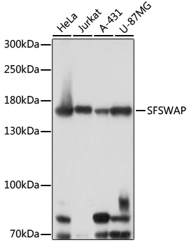 Western blot - SFSWAP Polyclonal Antibody 