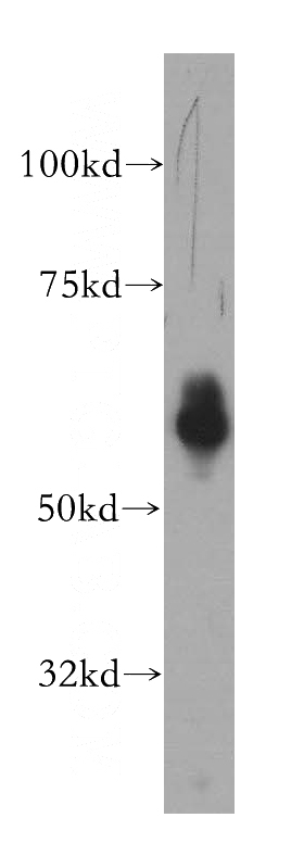 mouse thymus tissue were subjected to SDS PAGE followed by western blot with Catalog No:113770(PFKFB3 antibody) at dilution of 1:600