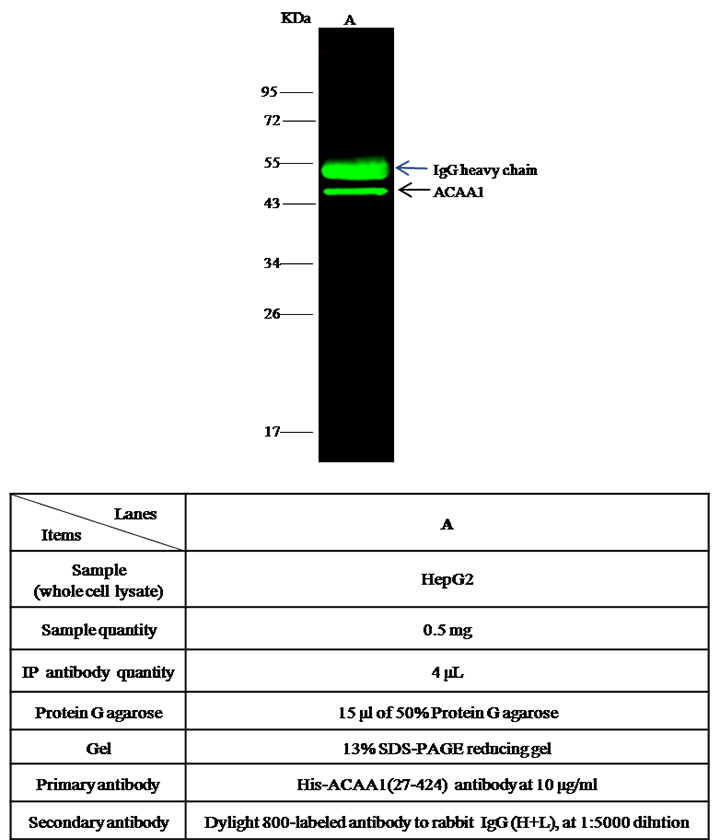 Human ACAA1/Peroxisomal 3-oxoacyl-CoA thiolase Immunoprecipitation(IP) 15719
