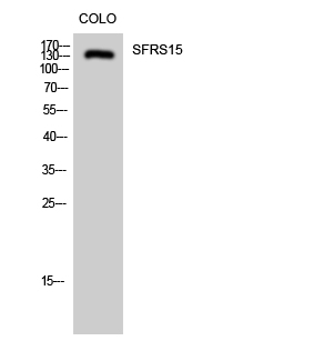 Fig1:; Western Blot analysis of COLO cells using SFRS15 Polyclonal Antibody diluted at 1: 2000 cells nucleus extracted by Minute TM Cytoplasmic and Nuclear Fractionation kit (SC-003,Inventbiotech,MN,USA).