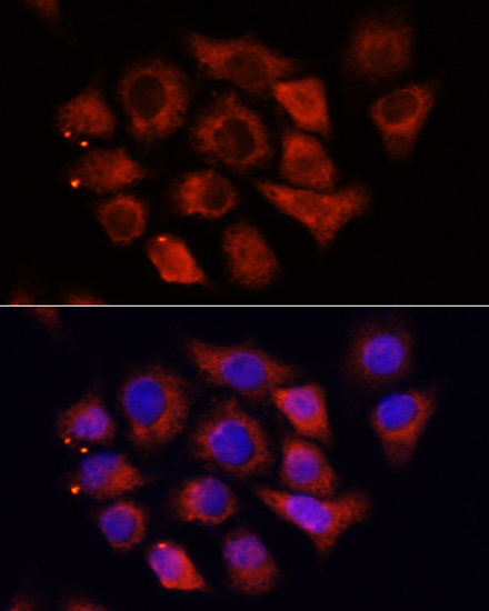 Immunofluorescence - HMGA1 Polyclonal Antibody 