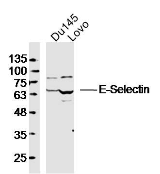 Fig3: Sample:; DU145 Cell Lysate at 40 ug; LOVO Cell Lysate at 40 ug; Primary: Anti-E-Selectin (wt-p53) at 1/300 dilution; Secondary: IRDye800CW Goat Anti-Rabbit IgG at 1/20000 dilution; Predicted band size: 65 kD; Observed band size: 63 kD