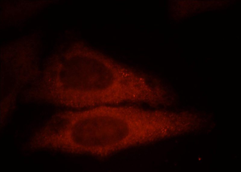 Immunofluorescent analysis of HepG2 cells, using UBE2G1 antibody Catalog No:116525 at 1:25 dilution and Rhodamine-labeled goat anti-rabbit IgG (red).