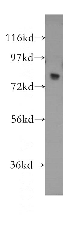 human liver tissue were subjected to SDS PAGE followed by western blot with Catalog No:112585(MED17 antibody) at dilution of 1:600